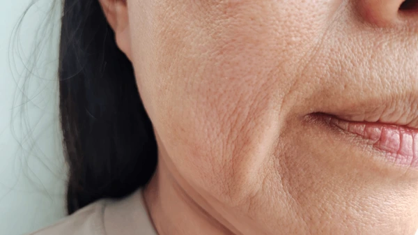 Conditions Aged Skin Treatment