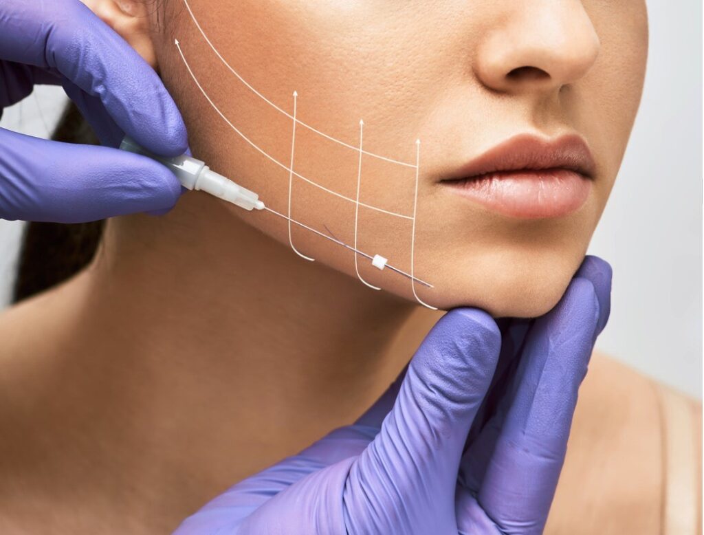 Transform Your Appearance with a Face Thread Lift in Abu Dhabi face thread lift abu dhabi