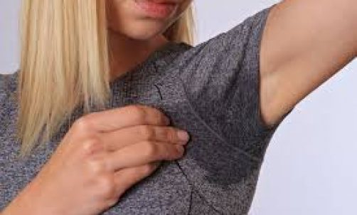 Hyperhidrosis