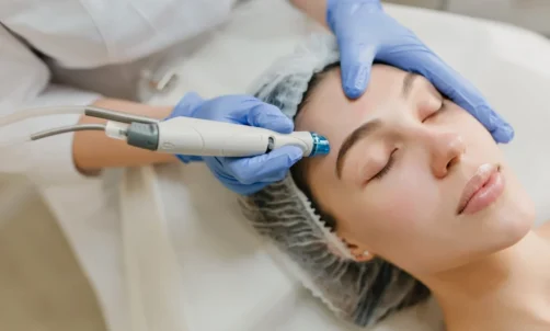 Mesotherapy for Face