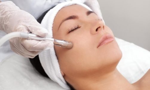 Microdermabrasion